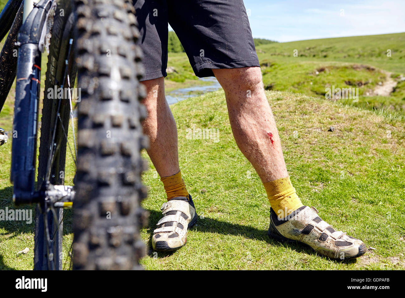 Verkürzten Blick auf Radfahrer Blutungen Beine mit dem Fahrrad Stockfoto