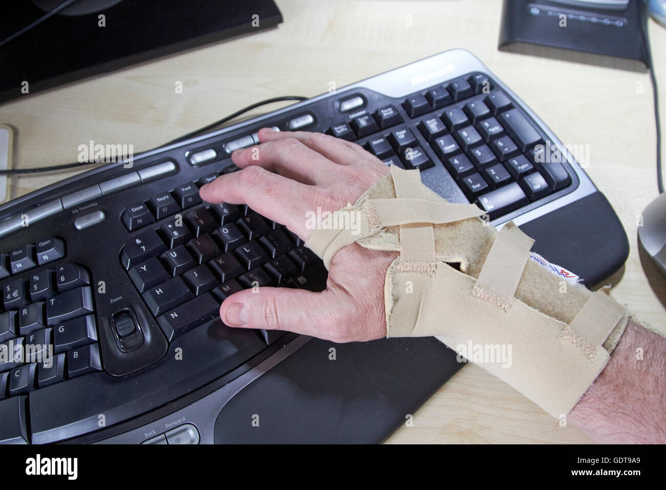 Mann trägt Handgelenk geteilt durch Karpaltunnelsyndrom über eine ergonomische Tastatur Stockfoto