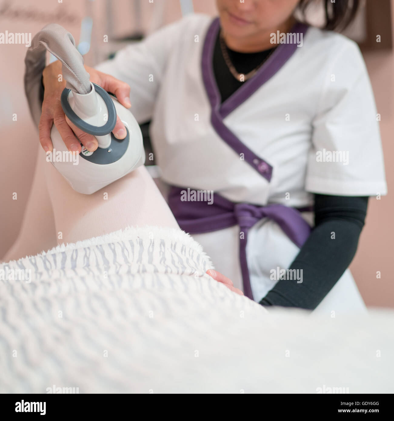 EVLT (endovenöse Laserbehandlung) zur Behandlung von Krampfadern. Stockfoto