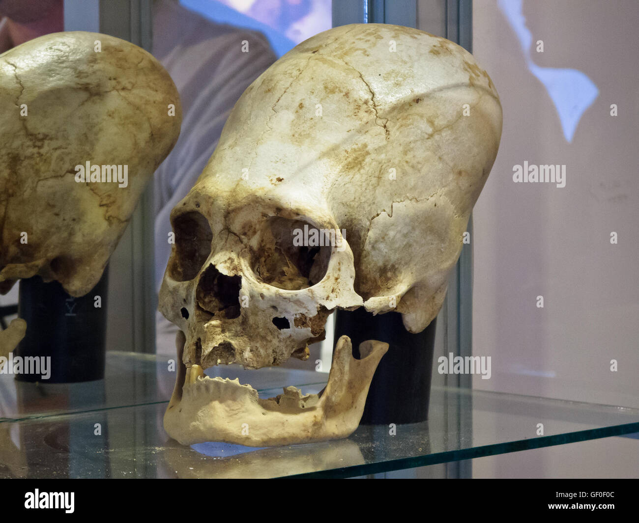 Langgestreckten Sie Schädel eines alten Paracas Mensch gezeigt im Paracas History Museum Stockfoto