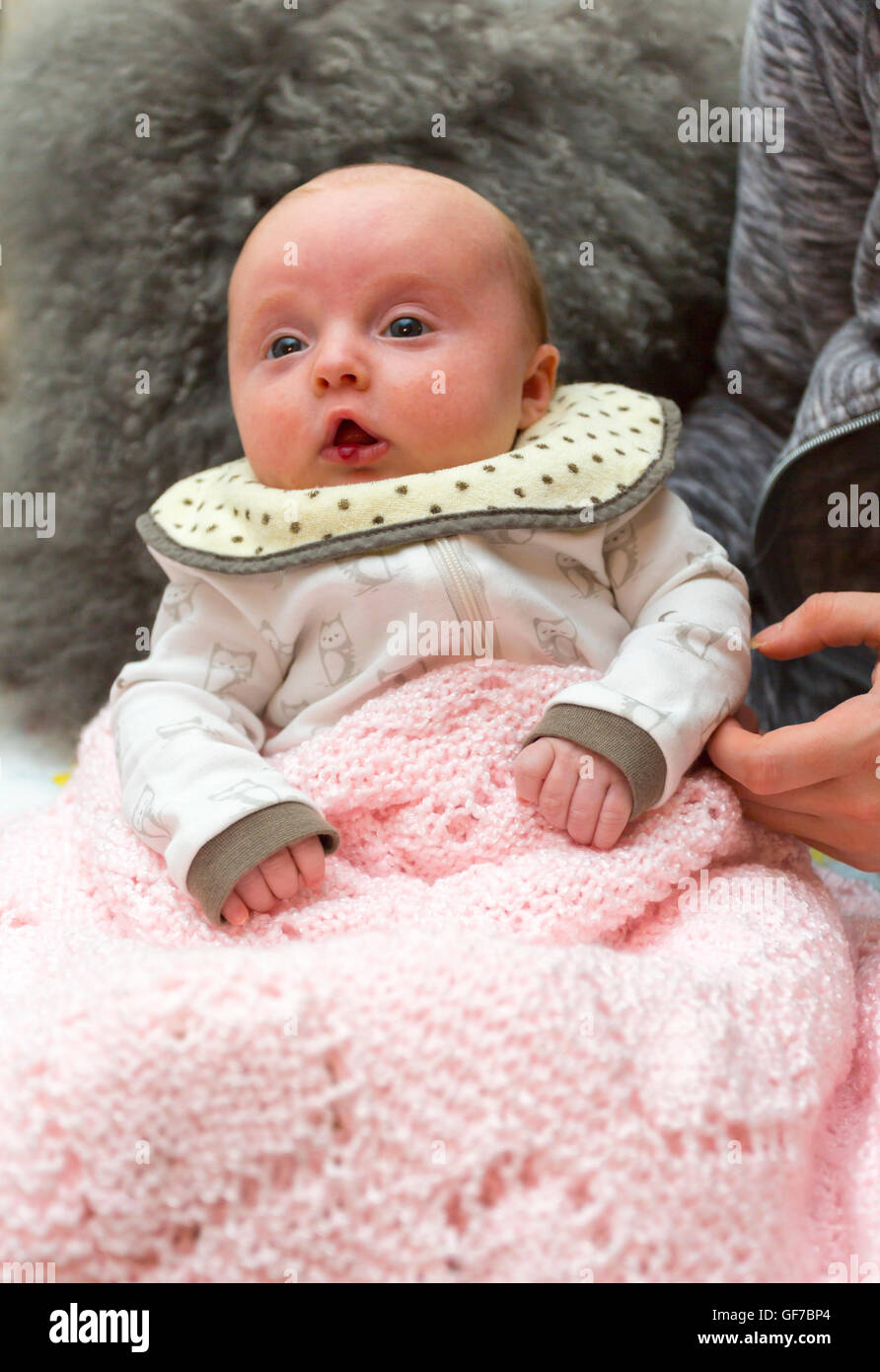 2 Monate alten Säugling mit Hämangiom, gutartiger Tumor auf ihrer Unterlippe Stockfoto