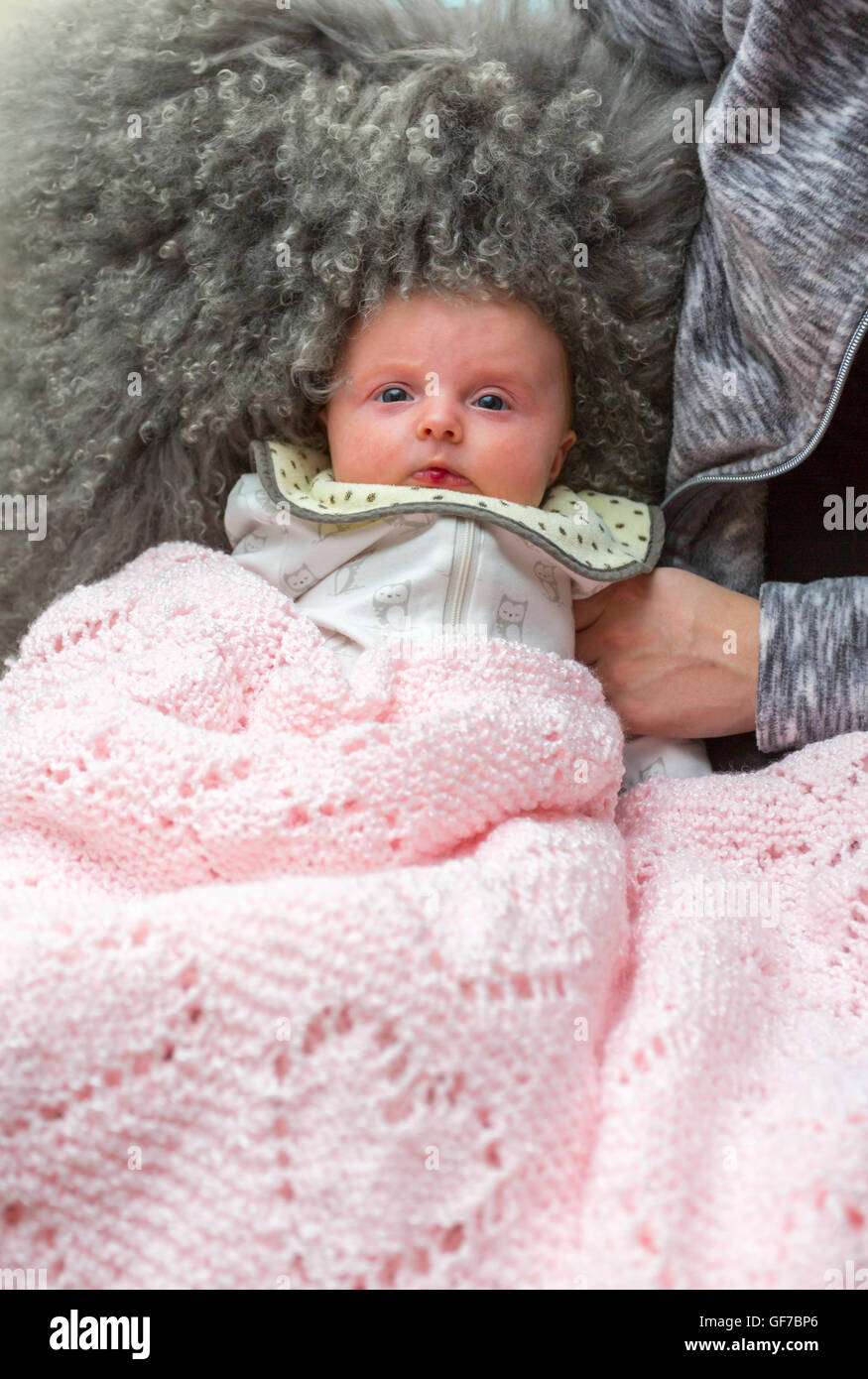 2 Monate alten Säugling mit Hämangiom, gutartiger Tumor auf ihrer Unterlippe Stockfoto