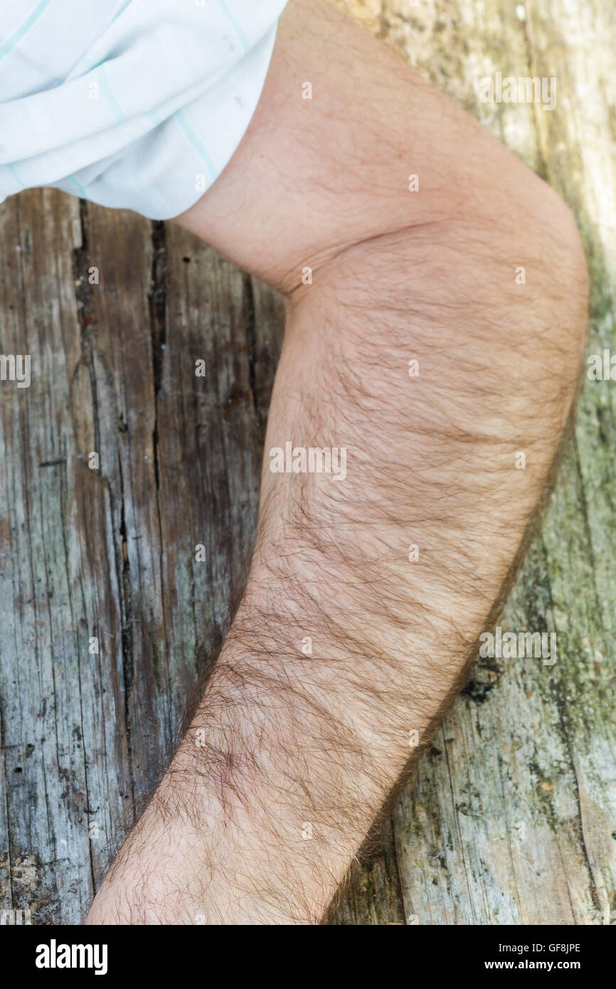 Körperteil: Hand weiße behaarte Männer Stockfoto