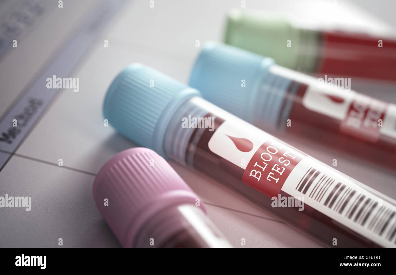 Rohre mit Blut für wissenschaftliche und medizinische Tests. Schärfentiefe mit Fokus auf den Bluttest-Label. Stockfoto