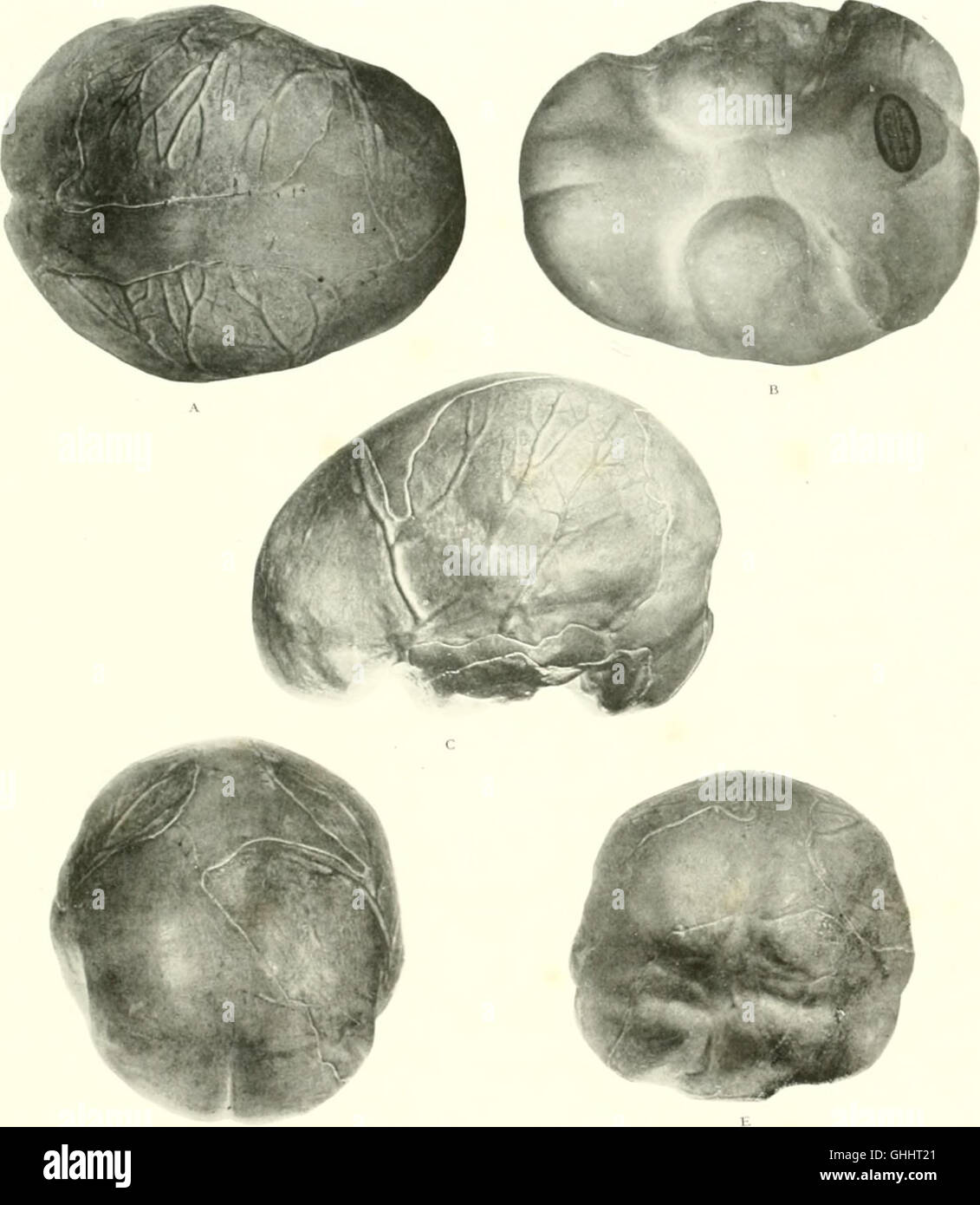 Diese Arbeit aus dem Jahr 1928 untersucht die evolutionäre Entwicklung des menschlichen Gehirns, indem sie seine Ursprünge von Primaten bis hin zum modernen Menschen zurückverfolgt und wichtige physiologische und strukturelle Veränderungen im Zeitverlauf hervorhebt. Stockfoto