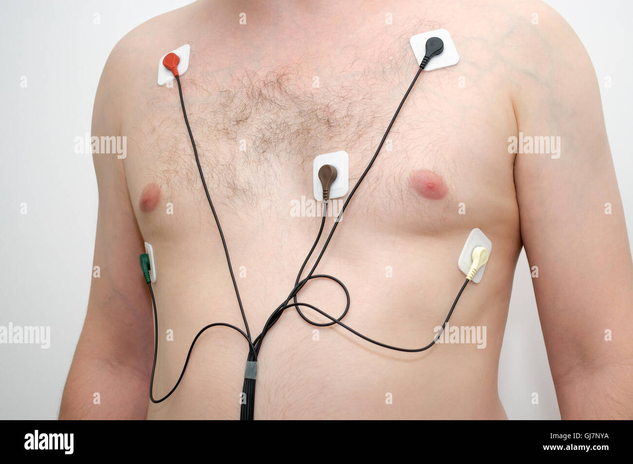 Ein Mann mit Holter-Monitor-Gerät Stockfoto