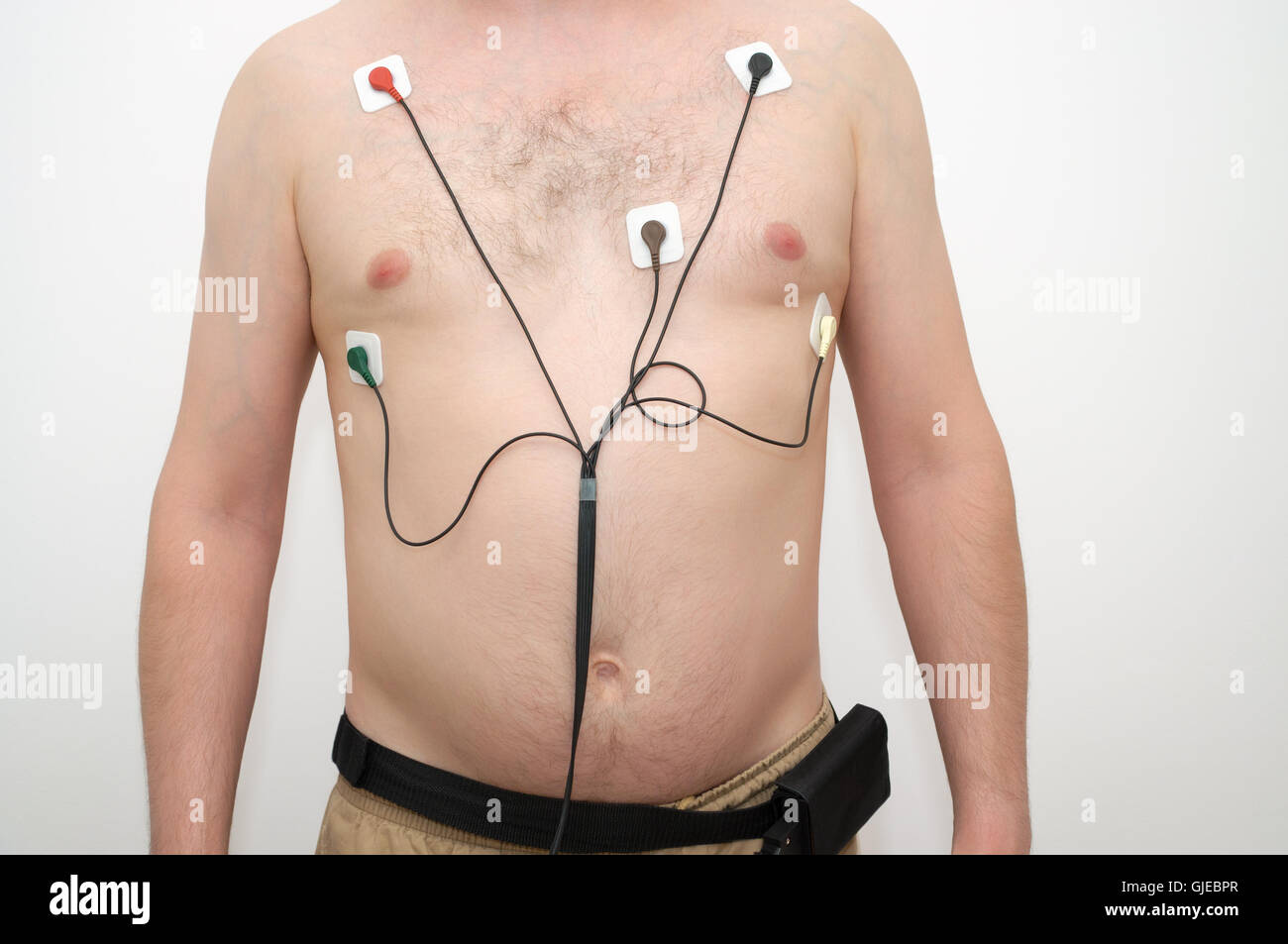 Ein Mann mit Holter-Monitor-Gerät Stockfoto