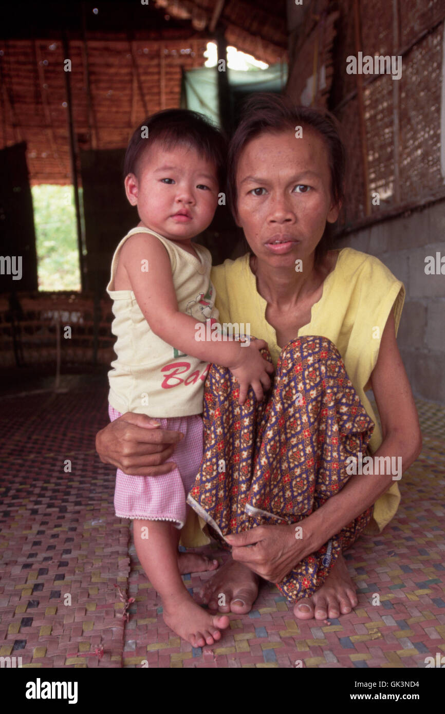 ca. 1980-1995, Thailand---HIV Positive Thai Mutter mit Kind---Bild von Jeremy Horner © Stockfoto