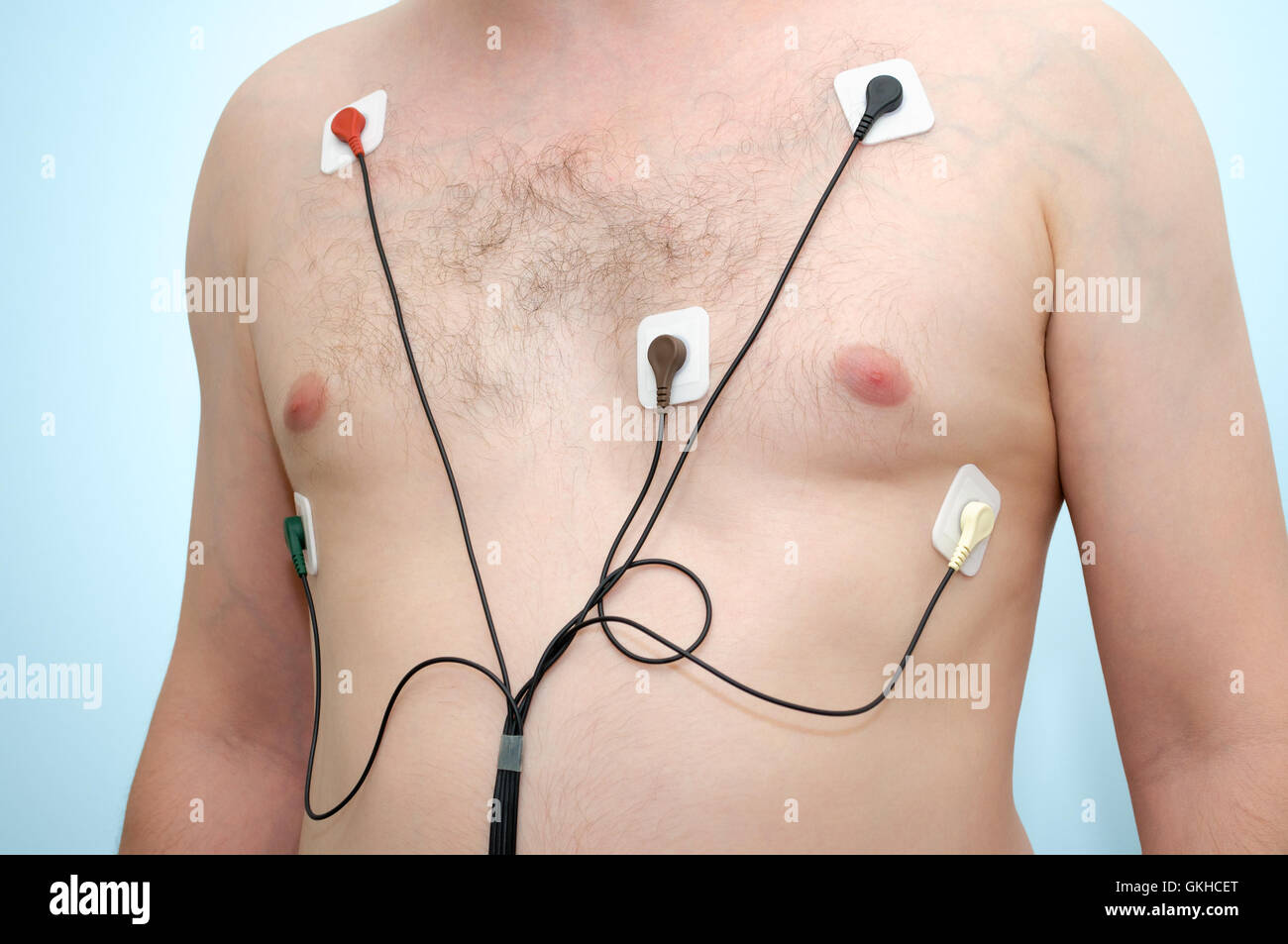 Ein Mann mit Holter-Monitor-Gerät Stockfoto