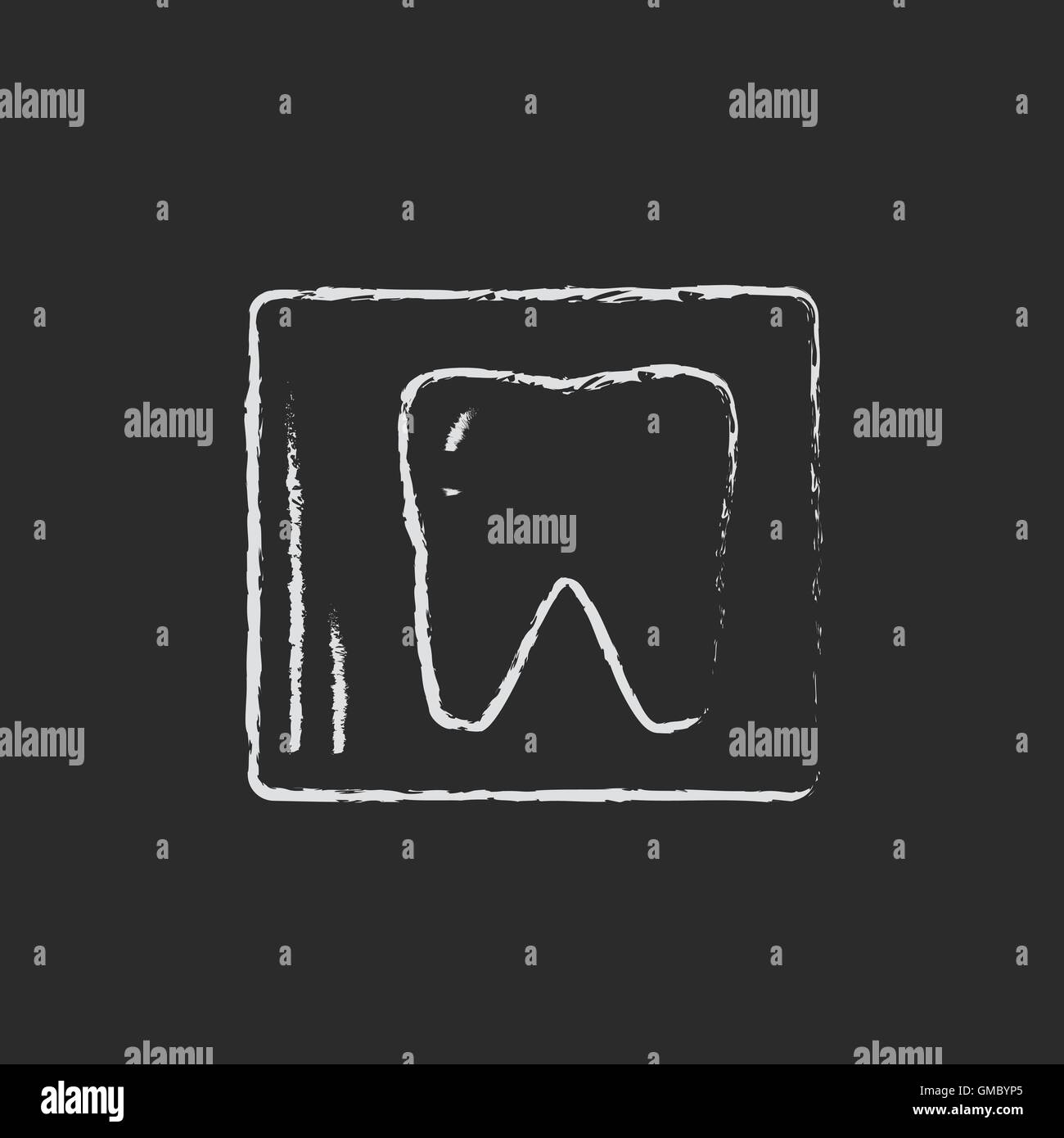 X-ray das Zahn-Symbol in der Kreide gezeichnet. Stock Vektor