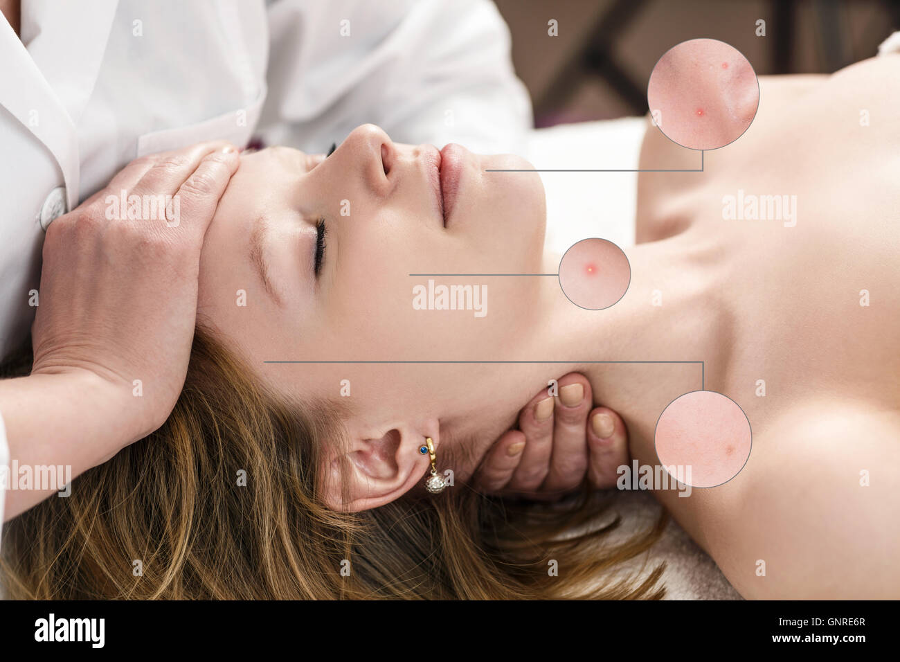 Weibliches Gesicht mit Zoom Kreisen mit Eingriff auf die Spa-Salon Stockfoto