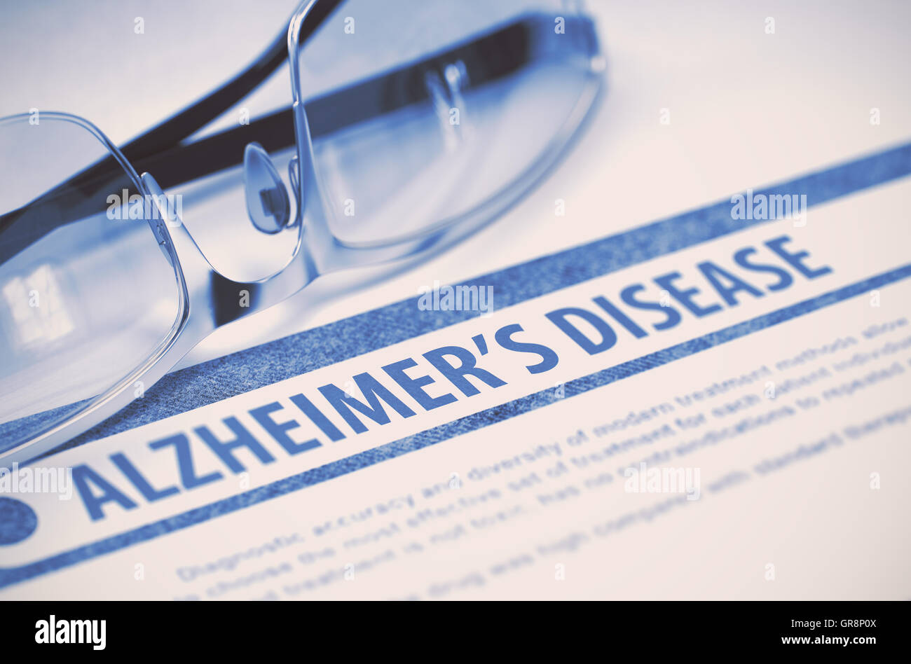 Alzheimer-Krankheit. Medizin. 3D Illustration. Stockfoto