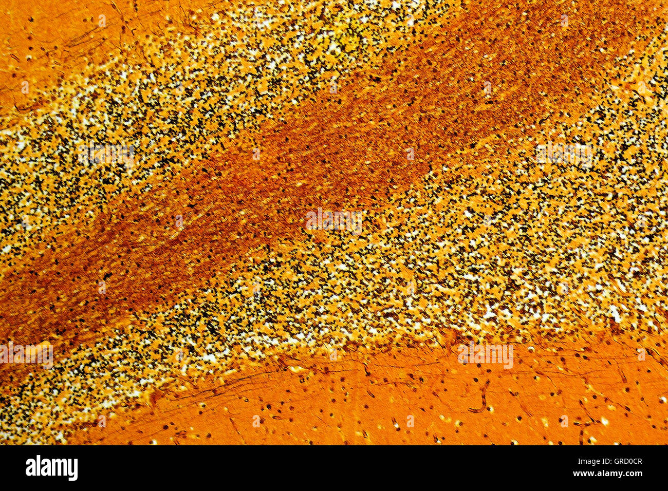 Menschlichen Kleinhirn Histoligical Folie Stockfoto