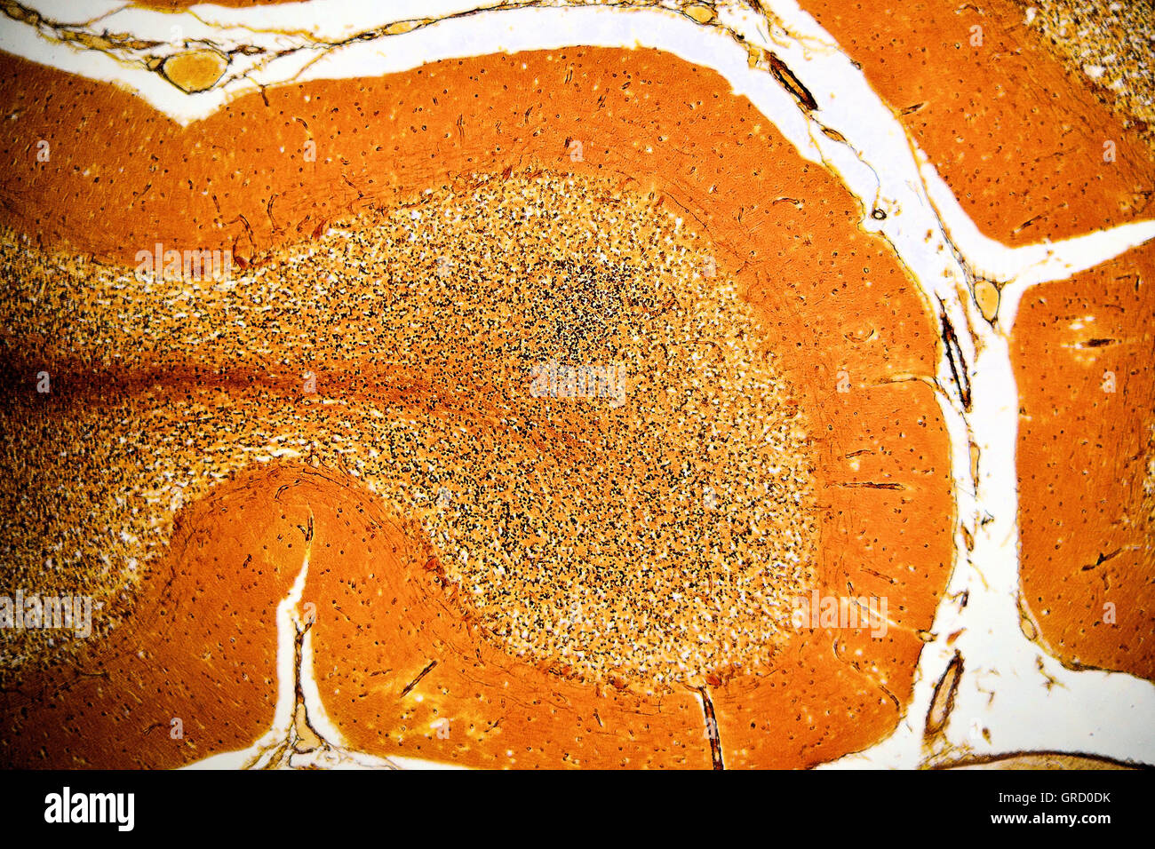 Menschlichen Kleinhirn Histoligical Folie Stockfoto