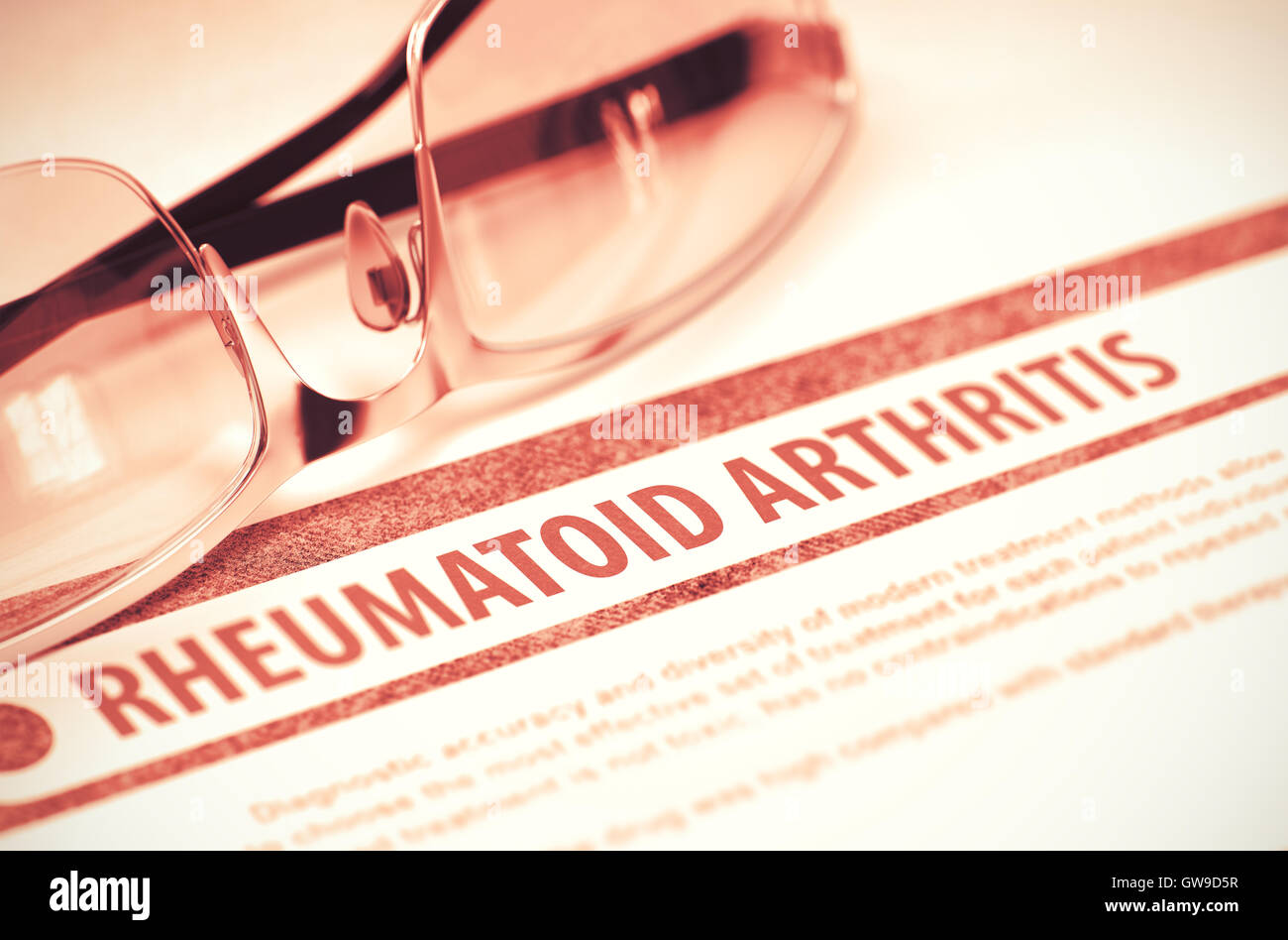 Rheumatoide Arthritis. Medizin. 3D Illustration. Stockfoto