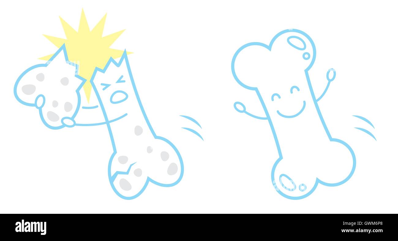 gesunde Knochen und Osteoporose Stock Vektor