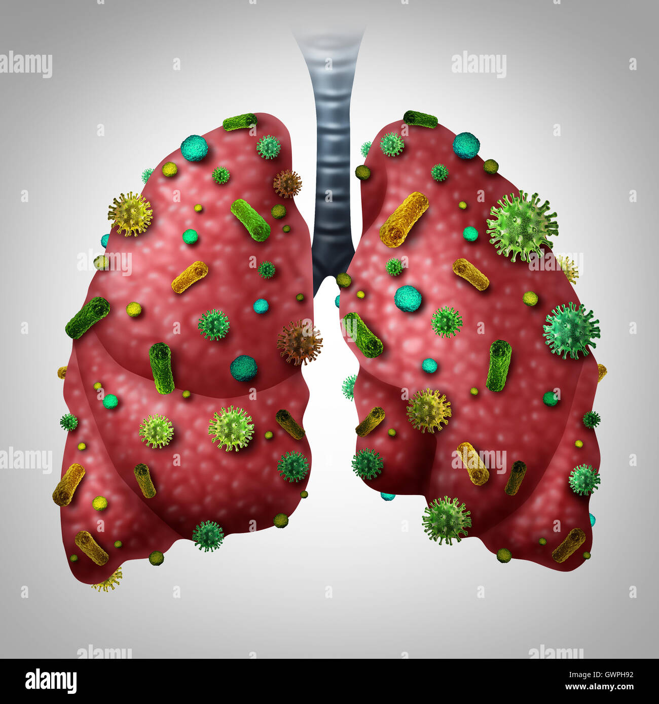Lungenentzündung-Infektion medizinisches Konzept als menschliche Lunge als Lunge Krankheit Diagnose mit 3D Abbildung Elemente von Viren und Bakterien infiziert. Stockfoto