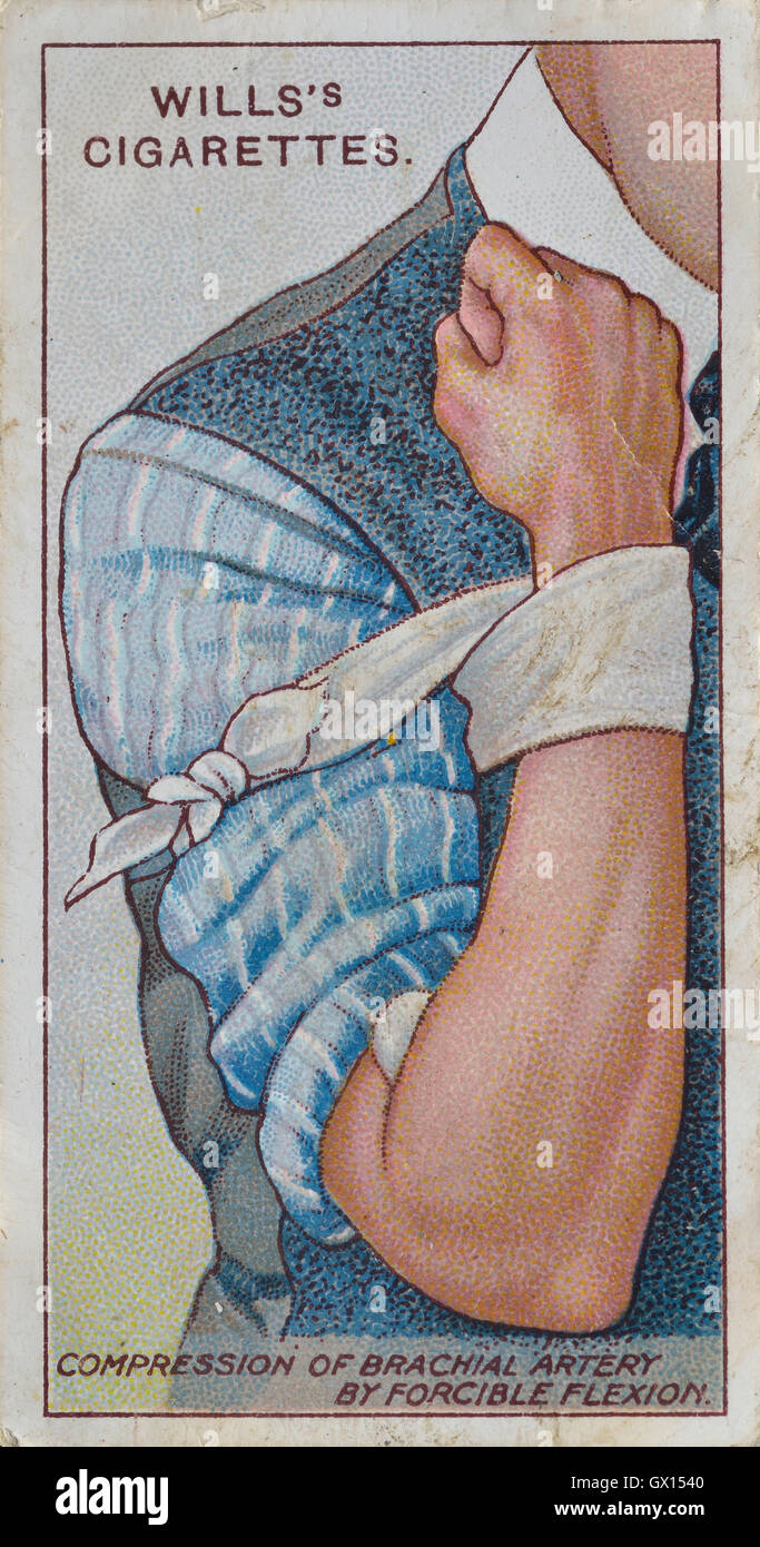 Wills Zigarette Karte der Kompression der Arterie Stockfoto