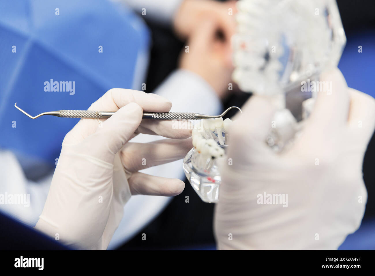 Nahaufnahme von Zahnarzt mit Zähnen und zahnärztliche Sonde Stockfoto