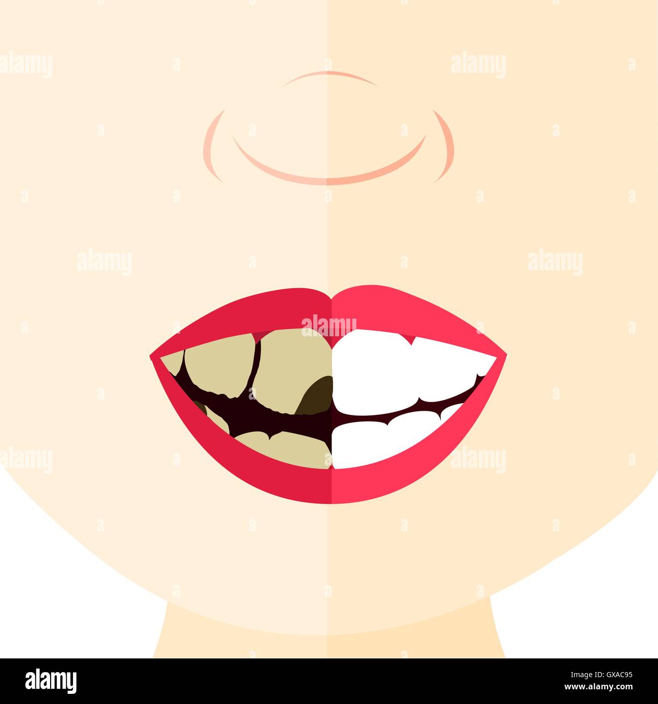 Vergleich zwischen gesunden und faulen Zahn. Gesicht in zwei Hälften geteilt. Stock Vektor