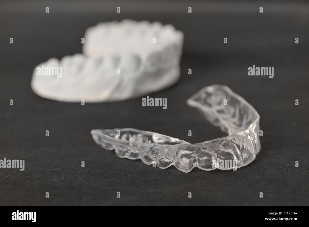 Zahn Klammern transparente Zahnspange um Zähne begradigen Stockfoto