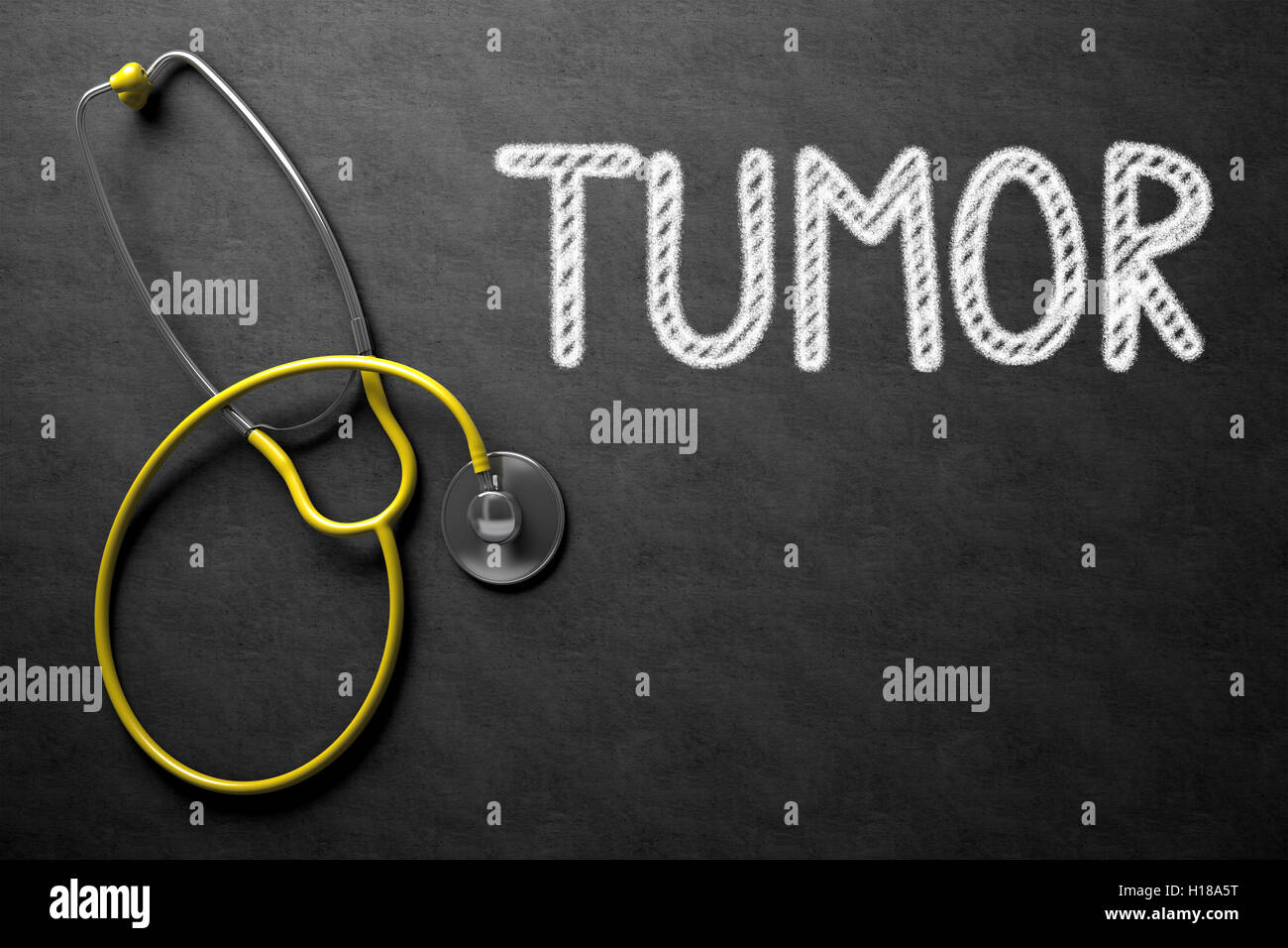 Tumor auf Tafel. 3D Illustration. Stockfoto