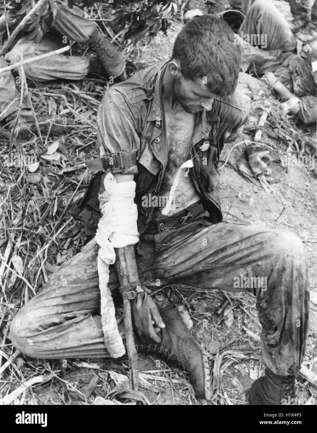 Ein US-Marine, seinen verletzten Arm in einer groben Schlinge wartet evakuiert werden. Die Marine war verwundet, als seine Firma überfallen wurde, während der Teilnahme an der OPERATION HASTINGS in der Nähe von Dong Ha. Stockfoto