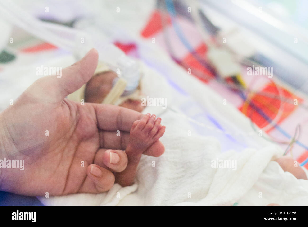 Vorzeitigen Neugeborenen unter Unterstützung der Atmung gelegt... Stockfoto