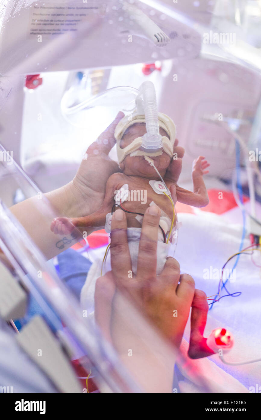 Vorzeitigen Neugeborenen unter Unterstützung der Atmung gelegt. Stockfoto