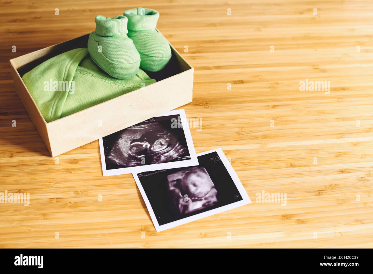 Baby Mädchen Ultraschall, normale und 4 D, neben einer Geschenkbox mit winzigen Kleidung und Schuhe auf Holz Stockfoto