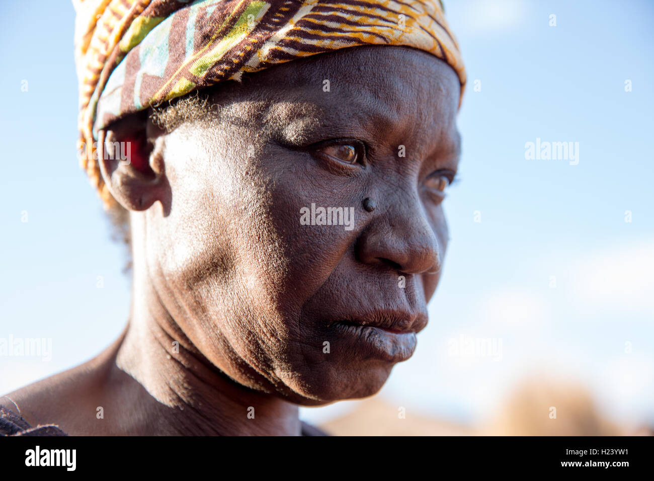 Namina Dorf, Provinz Nampula, Mosambik, August 2015: Maria Albino, 42, von Nampula und Ribaue Outreach-Team mit bilateralen Katarakt diagnostiziert wurde. Sie haben ihre Cataratcs in Ribaue Hopsital entfernt. Dieses Projekt wird von Sightsavers unterstützt. Foto: Mike Goldwater Stockfoto