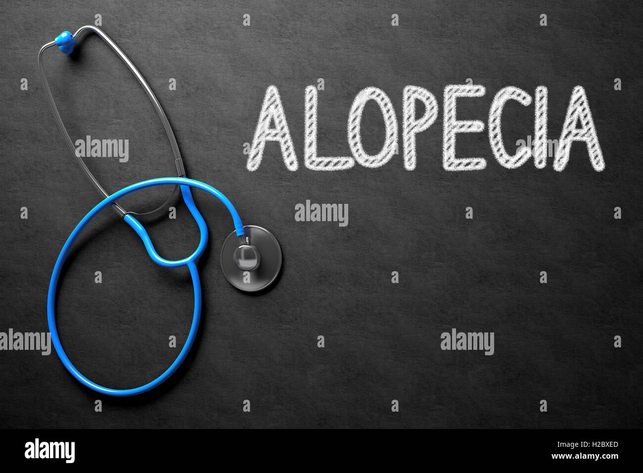 Tafel mit Alopezie Konzept. 3D Illustration. Stockfoto