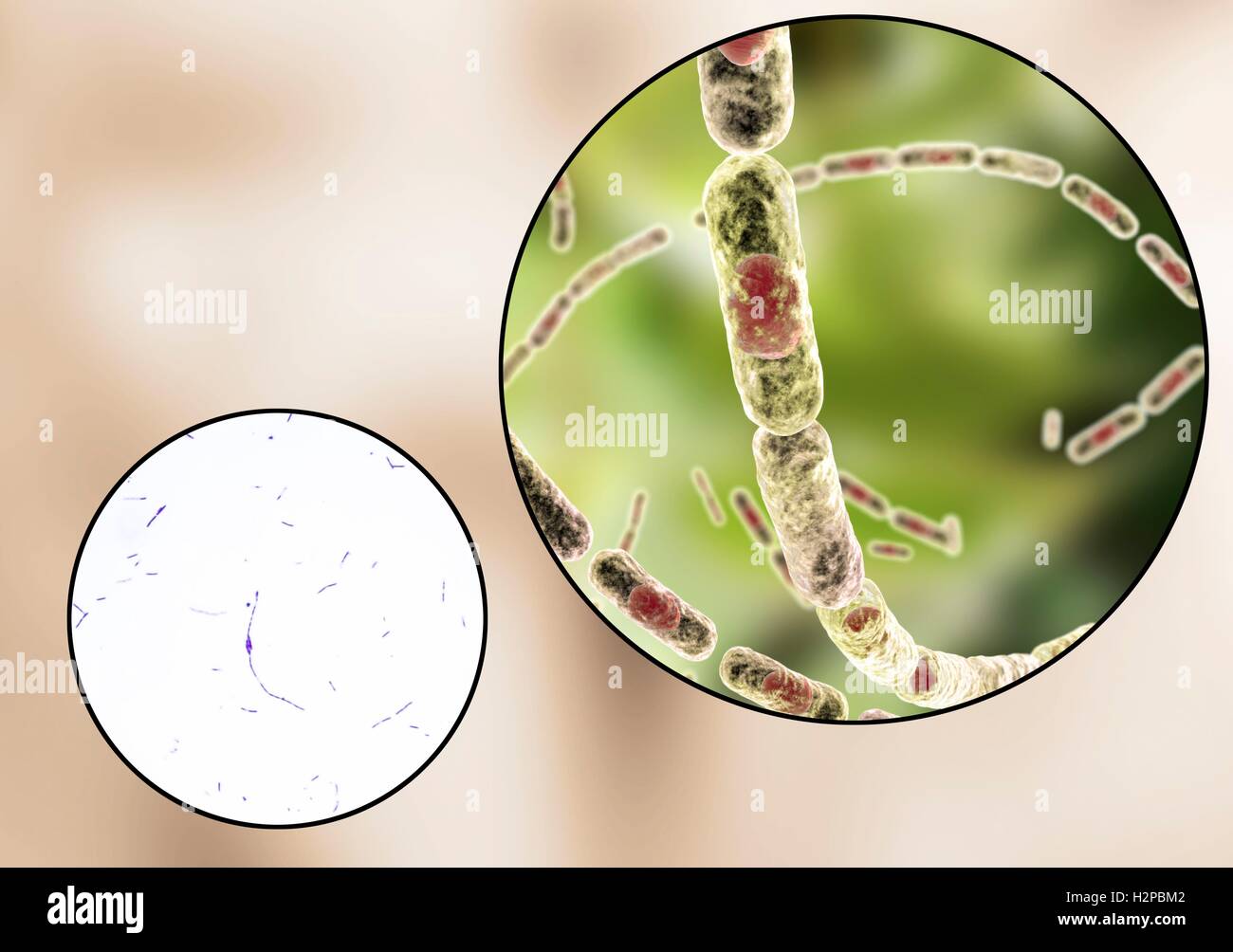 Milzbrandbakterien, leichte Schliffbild und Computer Illustration. Anthrax-Bakterien (Bacillus Anthracis) sind die Ursache für die Krankheit Milzbrand bei Mensch und Vieh. Sie sind grampositive Spore-produzierenden Bakterien, die in Ketten (Streptobacilli) angeordnet. Viele Zellen haben eine zentrale Spore (rot). Stockfoto