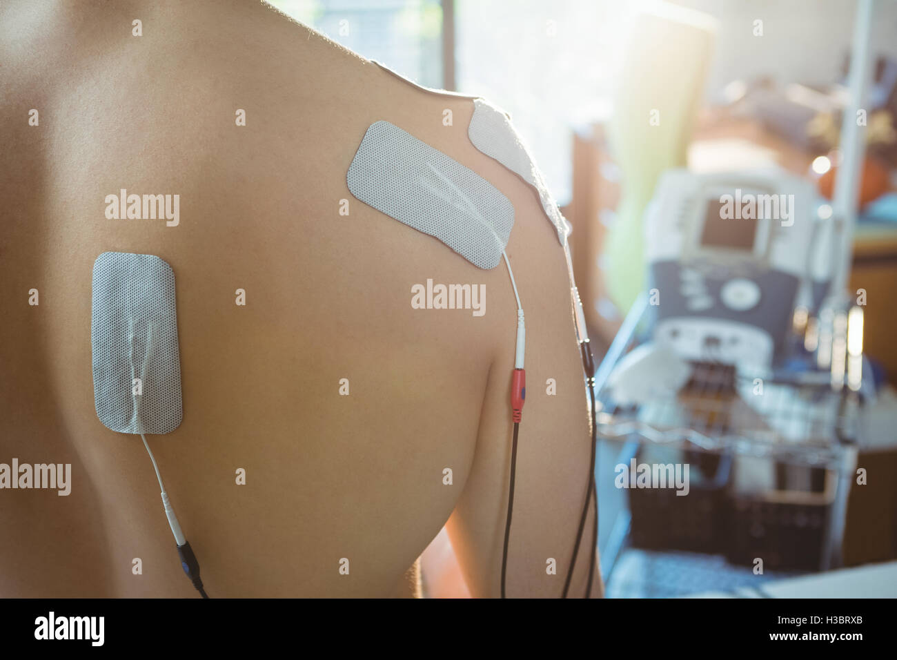 Männlicher Patient mit Elektro-Stimulator-Elektroden auf dem Rücken Stockfoto