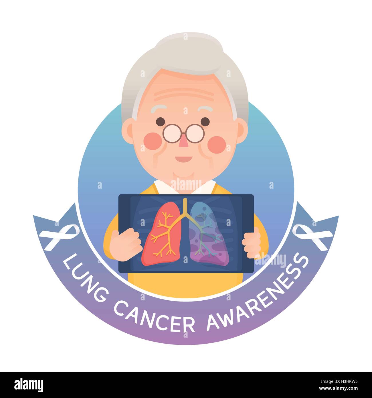 Vektor-Illustration von Alter Mann, hält Röntgen Bild zeigt Lungenkrebs Krebs Problem, weiße Schleife, Zeichentrickfigur Stock Vektor
