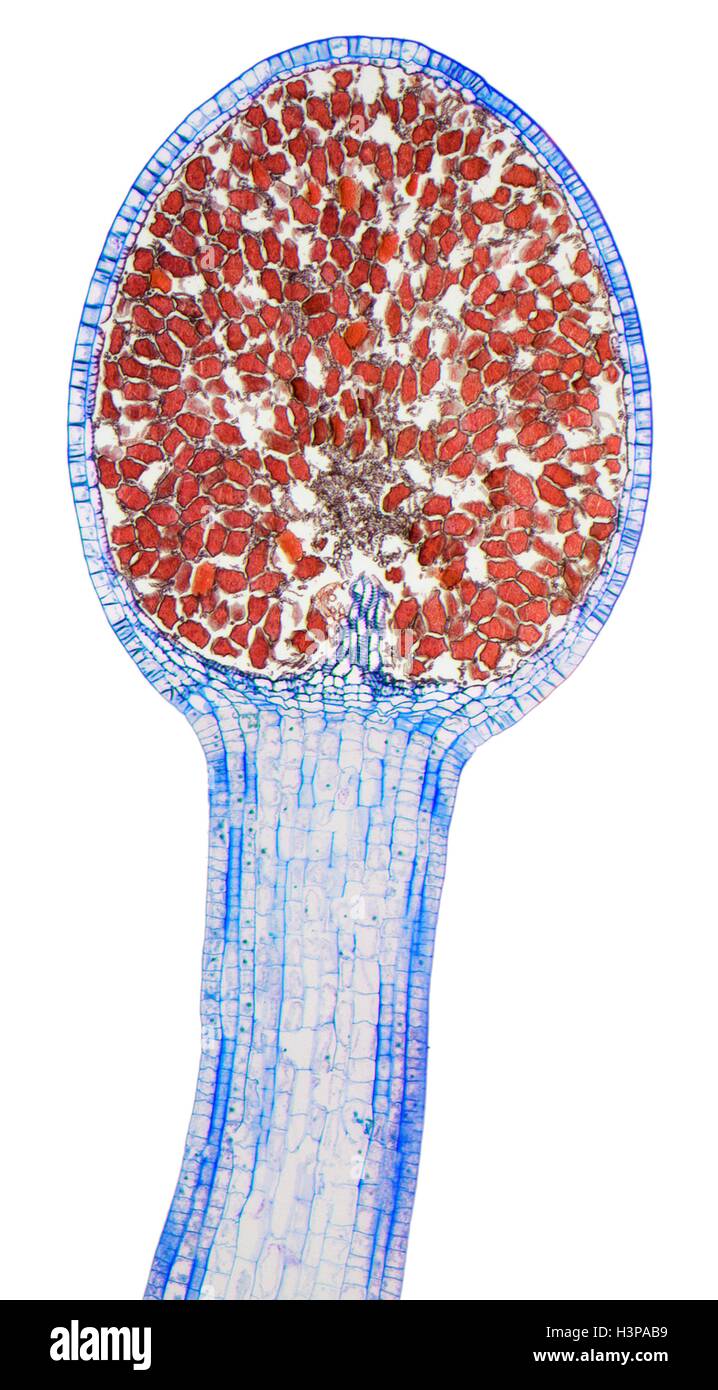 Lebermoos-Spore-Kapsel. Leichte Schliffbild (LM). Längsschnitt durch die Thallus und Sporangien von einem Lebermoos (Pellia Epiphylla). Die Sporangien (Spore Kapseln, oben Mitte) ist innerhalb der Thallus-Fall (Calyptra) eingeschlossen. Die Sporangien ist dicht gepackt mit kugelförmigen Sporen (rot), die entfernt von Luftströmungen getragen werden, wenn die Sporangien offen geteilt wird. Vergrößerung: X20 wenn bei 10 cm breite gedruckt. Stockfoto