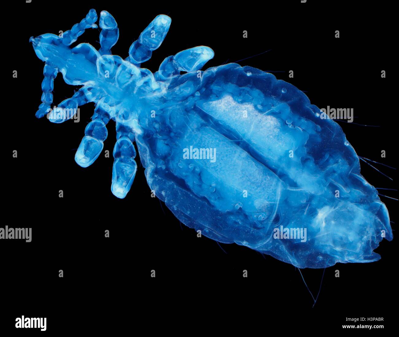 Menschlichen Kopf Laus, leichte Microraph (LM) 0f Pediculus Humanus