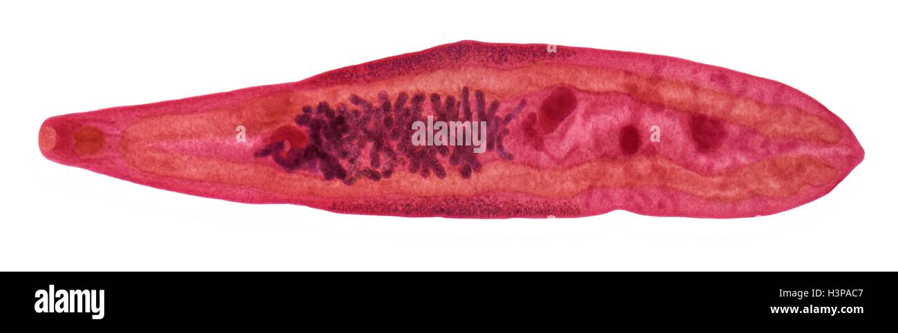 Leberegel. Leichte Schliffbild (LM) von dem Leberegel Clonorchis Sinensis, der Millionen von Menschen im Fernen Osten infiziert. Stockfoto