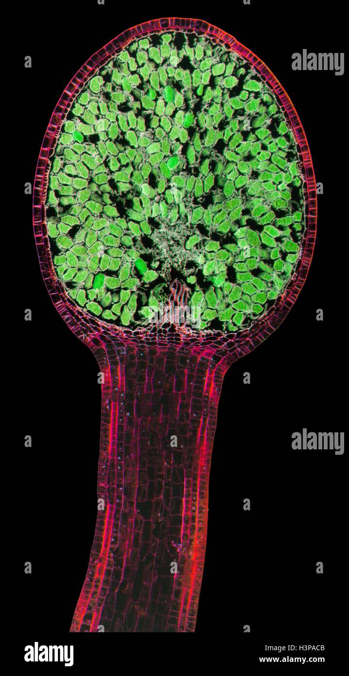 Lebermoos-Spore-Kapsel. Leichte Schliffbild (LM). Längsschnitt durch die Thallus und Sporangien von einem Lebermoos (Pellia Epiphylla). Die Sporangien (Spore Kapseln, oben Mitte) ist innerhalb der Thallus-Fall (Calyptra) eingeschlossen. Die Sporangien ist dicht gepackt mit kugelförmigen Sporen (grün), die entfernt von Luftströmungen getragen werden, wenn die Sporangien offen geteilt wird. Vergrößerung: X20 wenn bei 10 cm breite gedruckt. Stockfoto