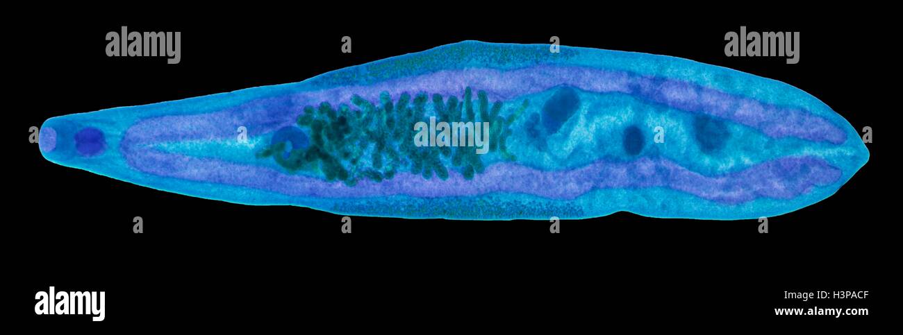 Leberegel. Leichte Schliffbild (LM) von dem Leberegel Clonorchis Sinensis, der Millionen von Menschen im Fernen Osten infiziert. Stockfoto