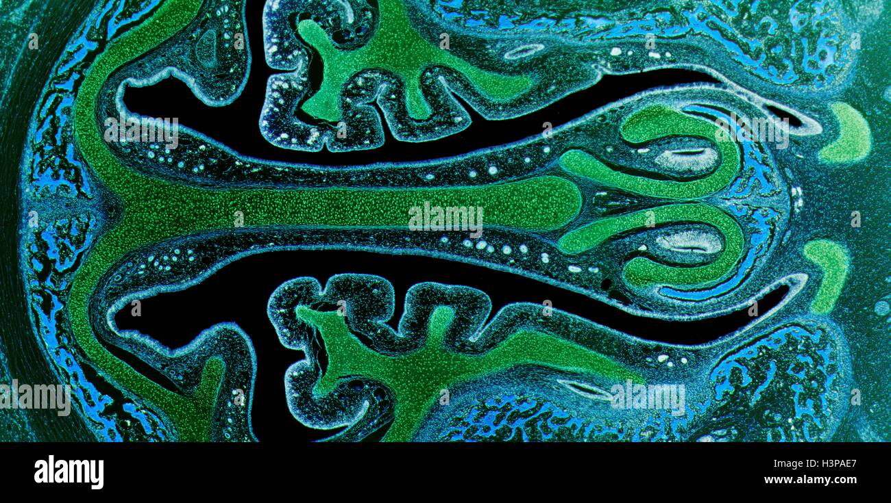 Nasennebenhöhlen. Leichte Schliffbild (LM) die Nasennebenhöhlen (durch Cyan Epithel ausgekleidet) und die unterstützenden Knorpel (grün). Knochengewebe wird durch die blauen Knochenmark identifiziert. Vergrößerung: X4 wenn bei 10 cm breite gedruckt. Stockfoto