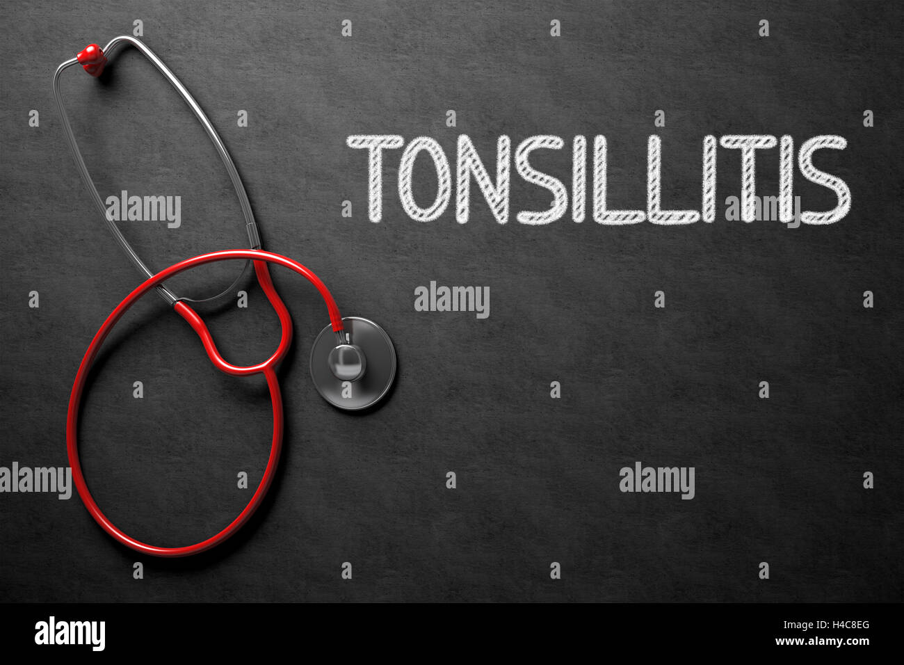 Mandelentzündung - Text auf Tafel. 3D Illustration. Stockfoto