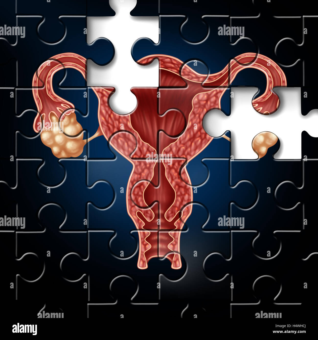 Herausforderung und Unfruchtbarkeit medizinische Fruchtbarkeitssymbol als eine unvollständige Puzzle mit einem Bild eines Uterus mit Eileiter als Gynäkologie-Ikone für Probleme in der weiblichen Reproduktion in einer 3D Darstellung Stil. Stockfoto