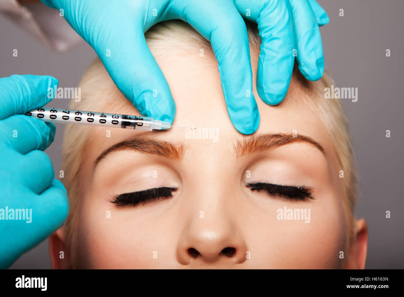 Schönes Gesicht der jungen Frau für Ästhetik Gesichtspflege Konzept Antifalten Stirn Botox Restylane Injektion von Kosmetik Stockfoto