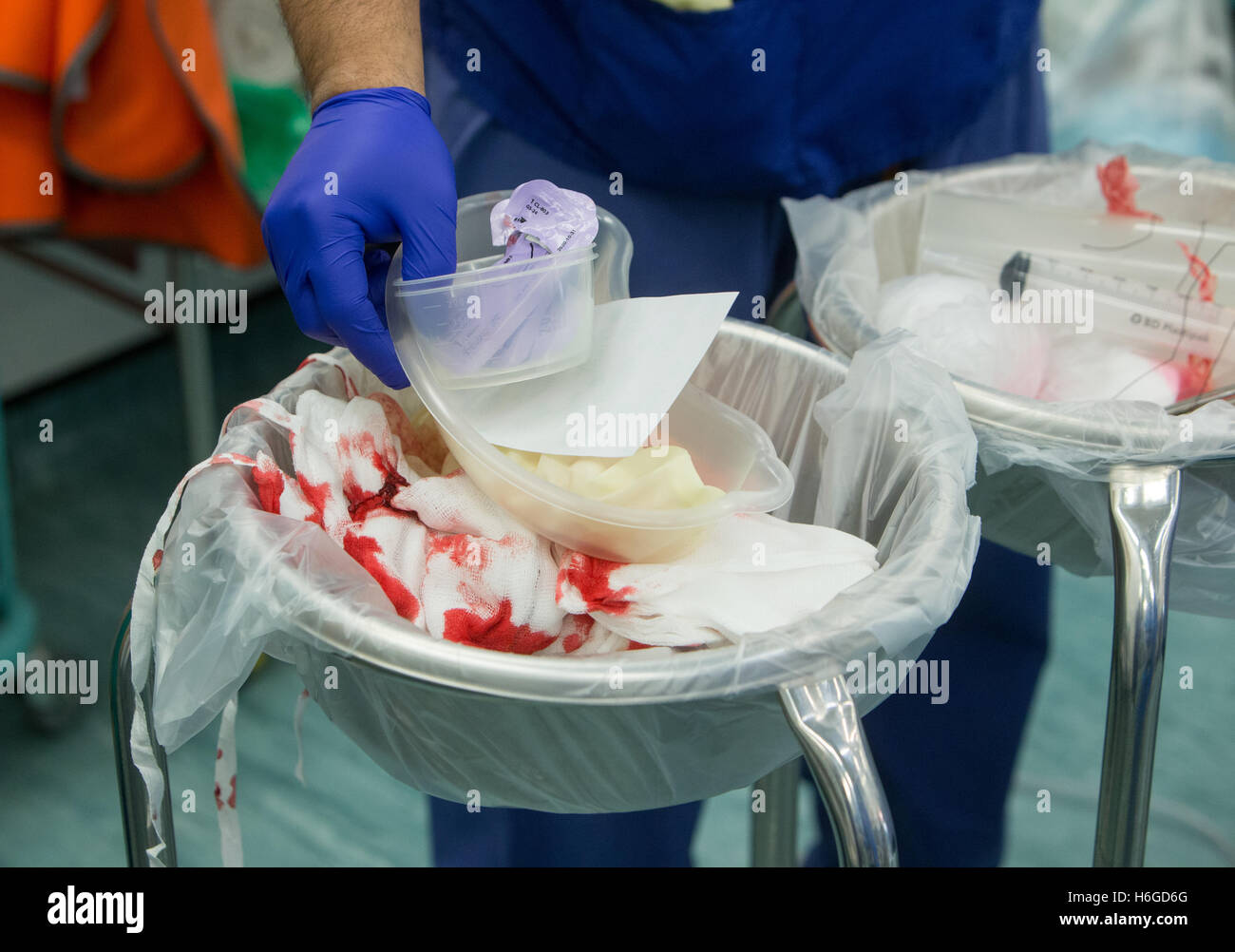 Ein Techniker in einem Operationssaal bringt gebrauchte Gegenstände in die Schüssel mit gebrauchten Tupfer Stockfoto