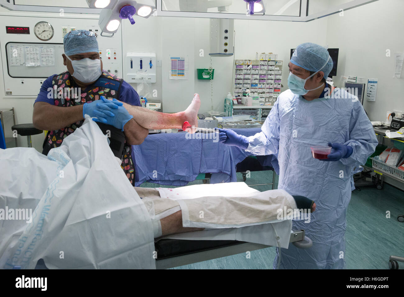 Ein Chirurg und Personal vorbereiten ein Patienten für eine Operation vor der Durchführung einer offenen Reposition und Osteosynthese des linken Sprunggelenks Stockfoto