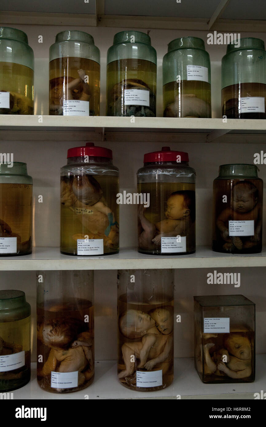 Gläser von Föten mit defekten vor der Exposition gegenüber Agent Orange Dioxin verwendet in den Vietnam-Krieg, Tu tun Krankenhaus Ho Chi Minh Stadt Stockfoto