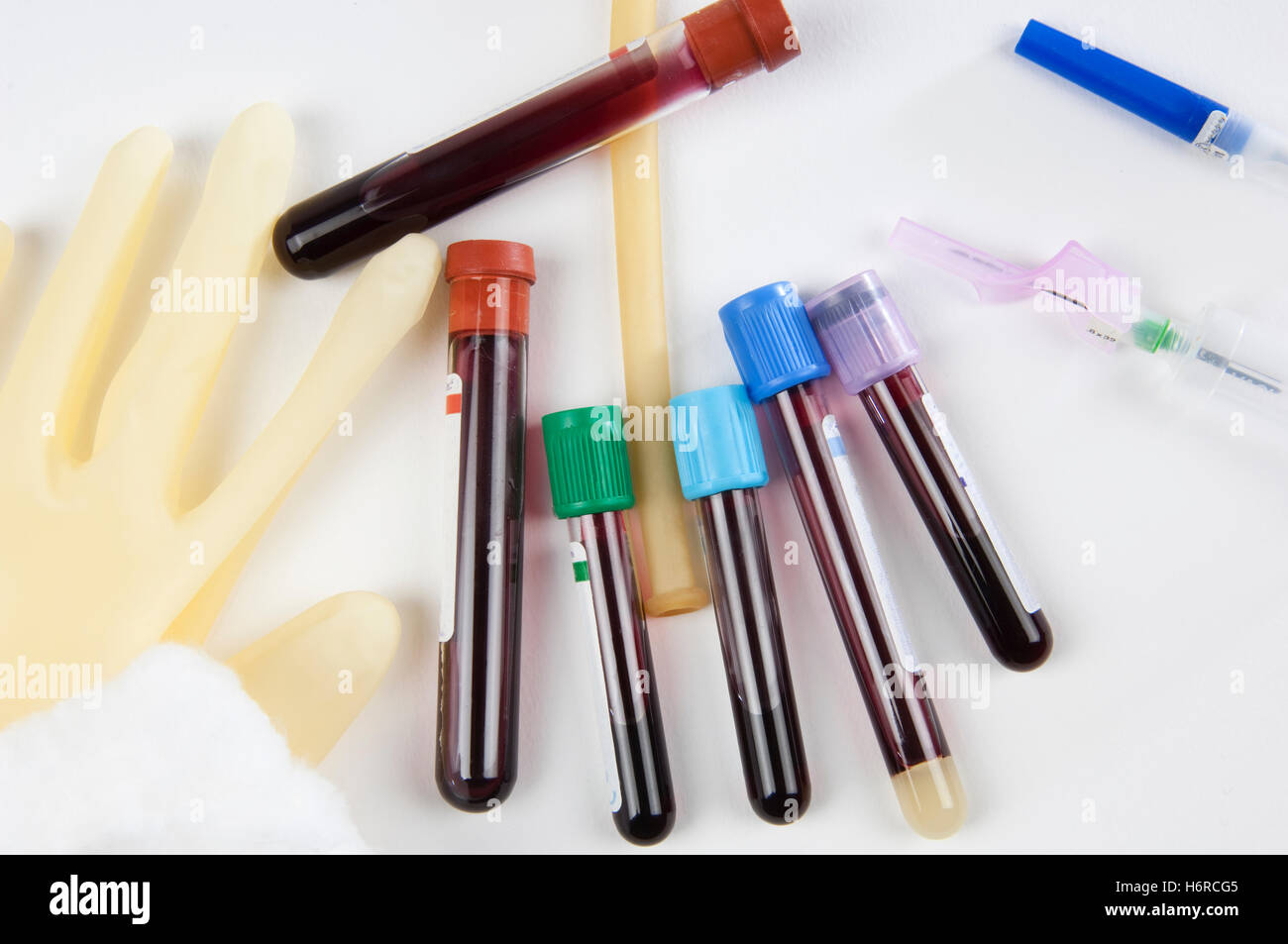 Glas Kelch Becher Gesundheitsforschung flüssige isolierte Wissenschaft gemessen Motivationsdruck Maßnahme Handschuh Krankenhaus Bluttest Rohr Kunststoff Stockfoto