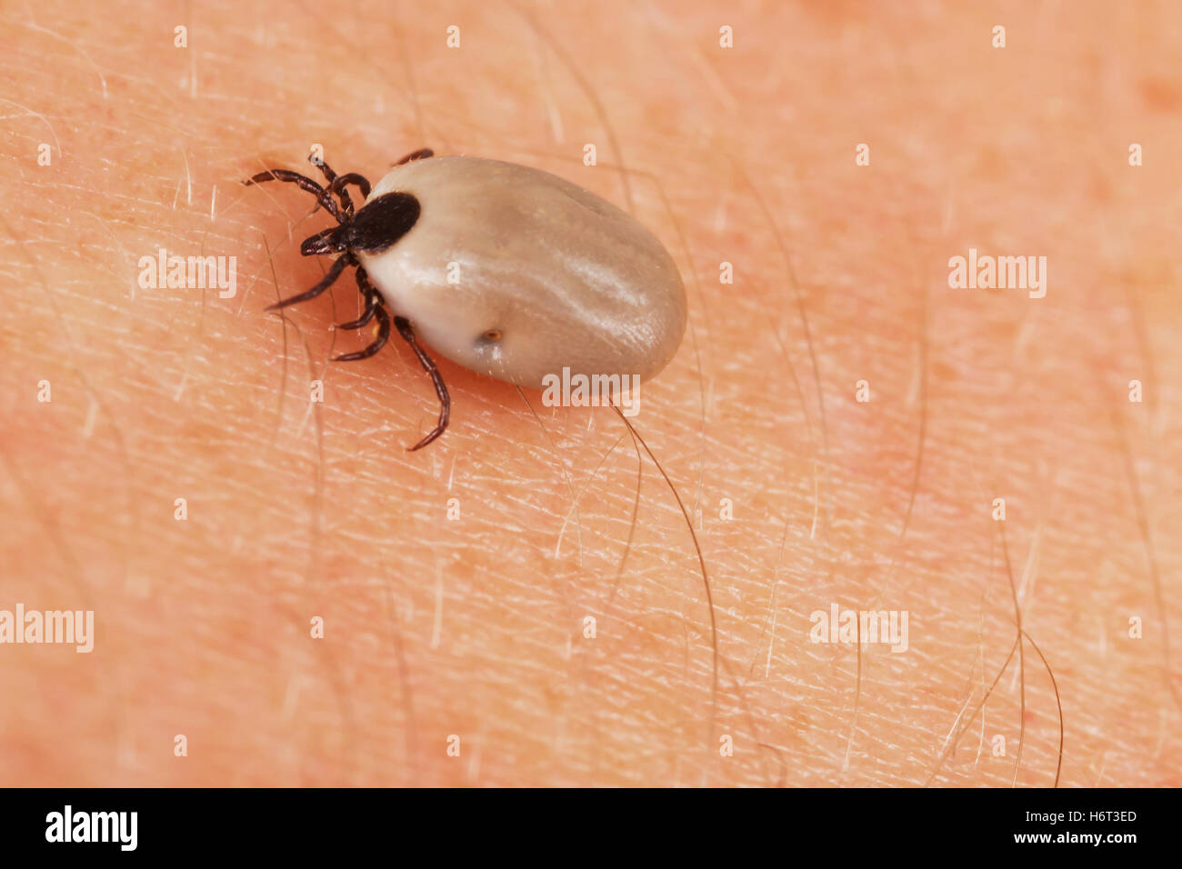 Tick u200bu200bon der Haut Stockfoto