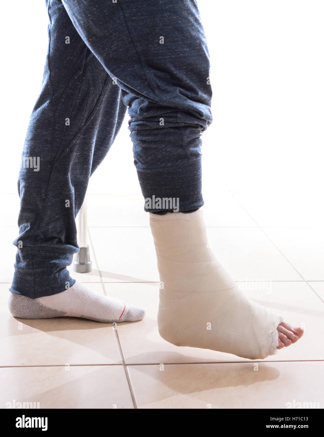 Junger Mann mit einem gebrochenen Knöchel und eine weiße werfen am Bein, zu Fuß auf Krücken (isoliert auf weiss) Stockfoto